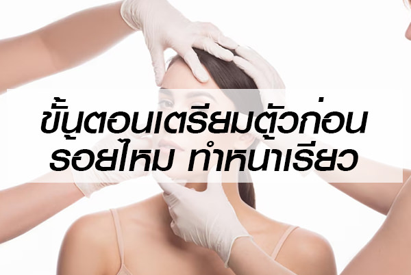 ขั้นตอนเตรียมตัวก่อน ร้อยไหม ทำหน้าเรียว