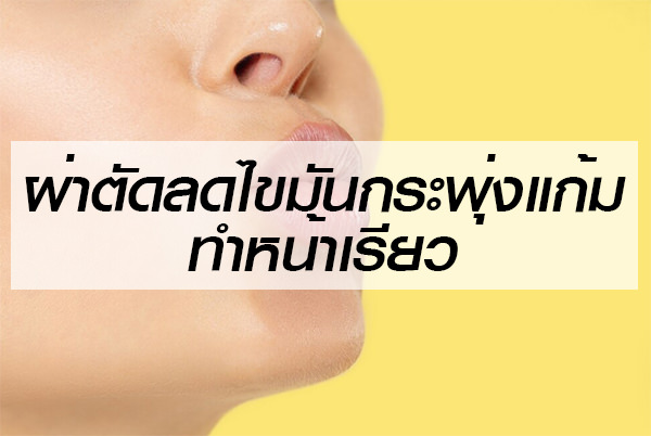 ผ่าตัดลดไขมันกระพุ่งแก้ม ทำหน้าเรียว
